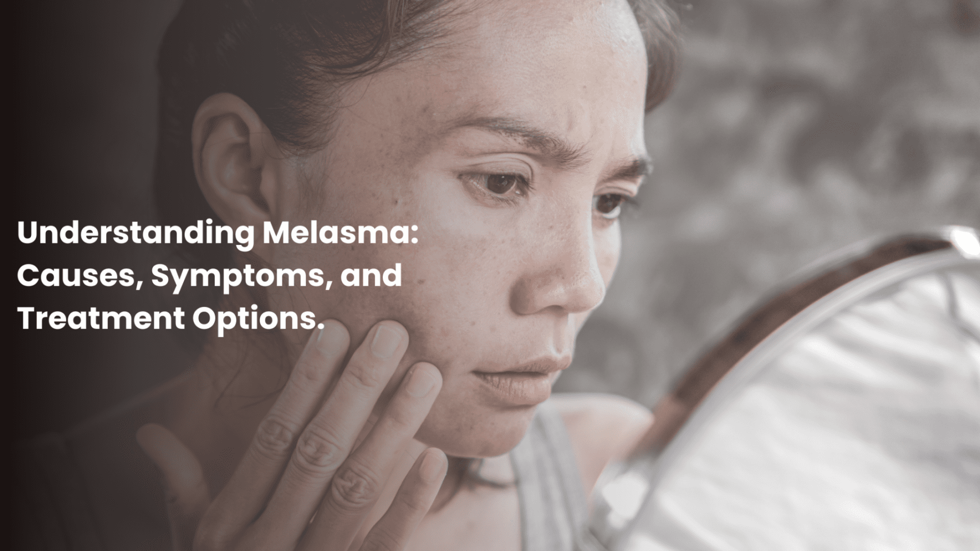 Understanding Melasma: Causes, Symptoms, and Treatment Options.
